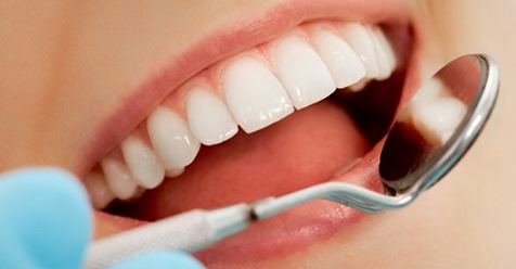 La carie dei denti potrebbero essere (anche) causate dal sistema immunitario