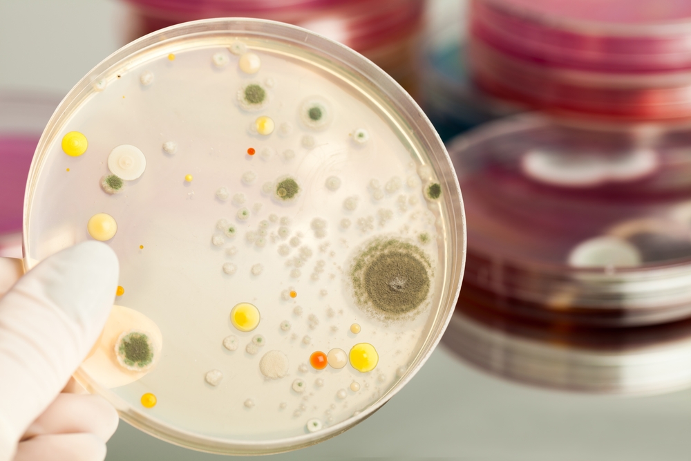 Uno studio identifica l'antibiotico resistenza tra le prime cause di morte